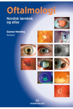 Oftalmologi : nordisk lærebok og atlas  (16. utg.)