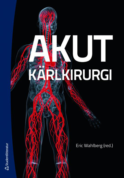 Akut kärlkirurgi